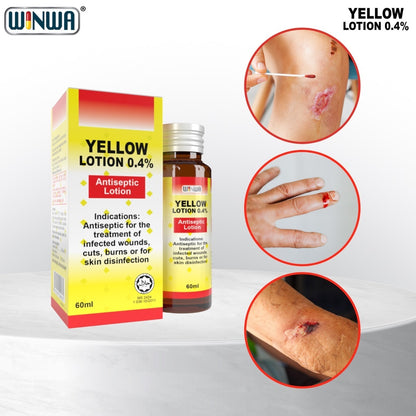 Winwa Yellow Lotion 0.4% Antiseptic Lotion Losyen Kuning Losyen Antiseptik (15ml/30ml/60ml )