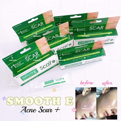 Ready Stock!!!SMOOTH E ACNE SCAR SERUM 7g 痘印祛疤膏