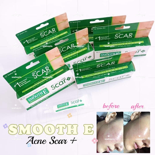 Ready Stock!!!SMOOTH E ACNE SCAR SERUM 7g 痘印祛疤膏