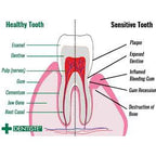 READY STOCK!!!DENTISTE' PLUS WHITE SENSITIVE GUM TOOTHPASTE 100g