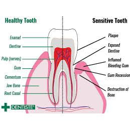 READY STOCK!!!DENTISTE' PLUS WHITE SENSITIVE GUM TOOTHPASTE 100g