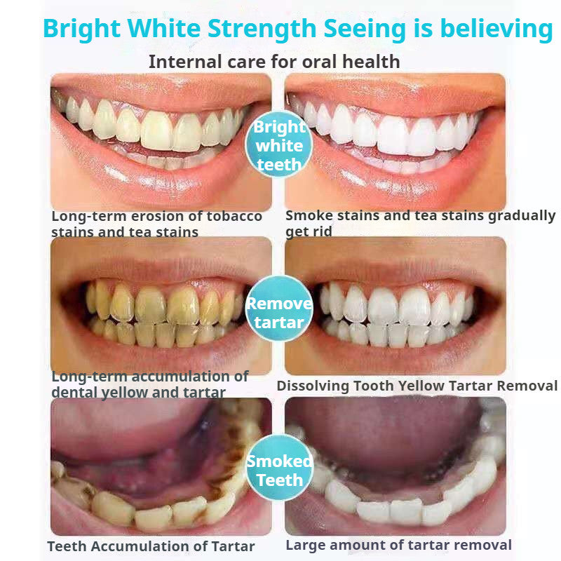 南京同仁堂 清凉薄荷 护龈洁白牙膏 Tongrentang Gingival Whitening Toothpaste 去除牙结石 黄牙 去口臭 牙渍 牙垢 牙齿变白膏 防蛀固齿 Teeth Whitening Gigi Putih