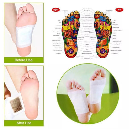 【READY STOCK】KINOKI Detox Foot Pad Cleansing Herbal Patch for Body Toxin Removal Foot Patch for Sleep & Circulation 艾草足贴
